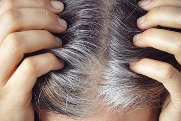 Natural Solutions for Scalp Issues: Effective Remedies and Prevention Tips