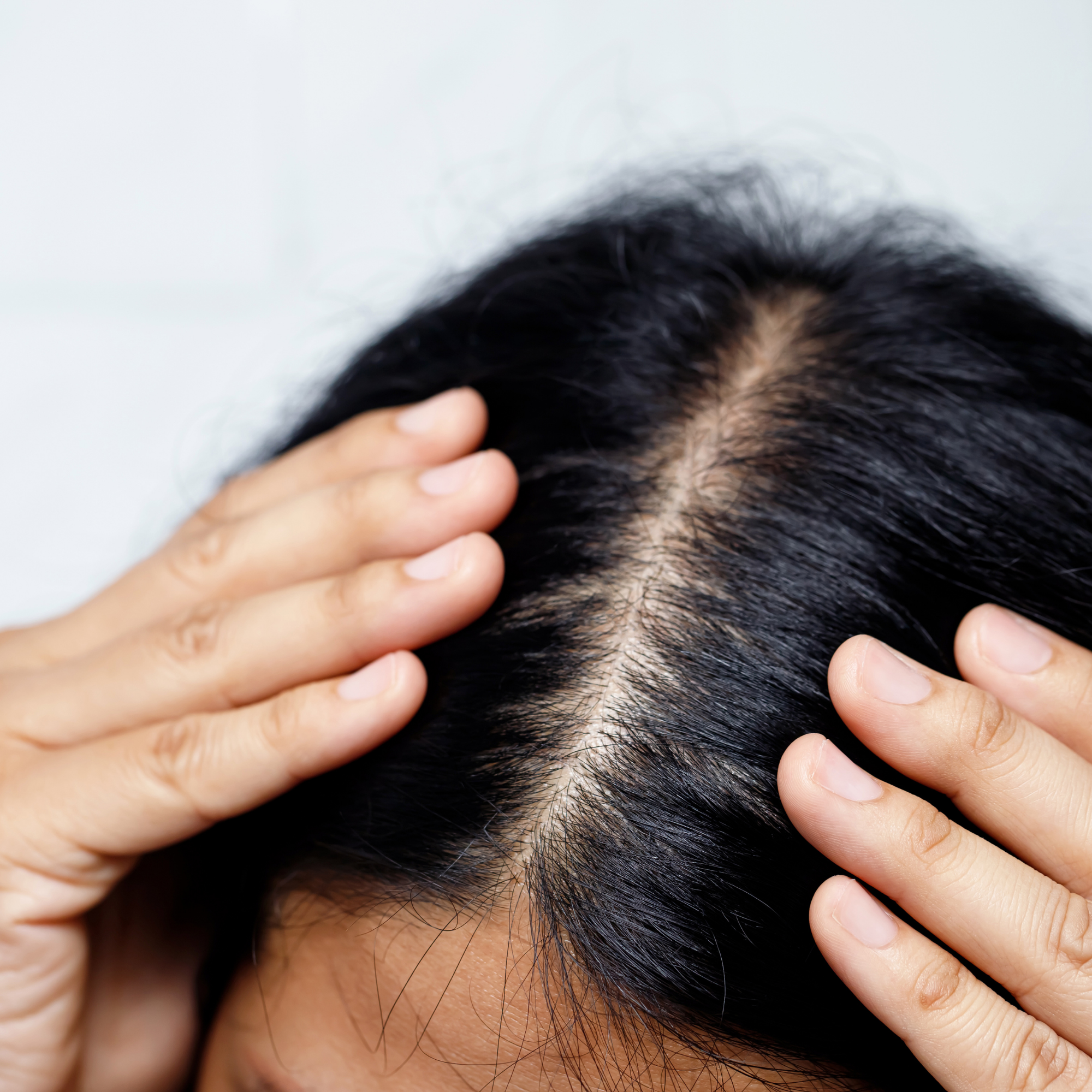 hair scalp balance natural oils dryness flakiness irritation Overwashing Hormonal Changes Poor Diet Stress weather conditions tea tree oat rosemary pumpkin argan